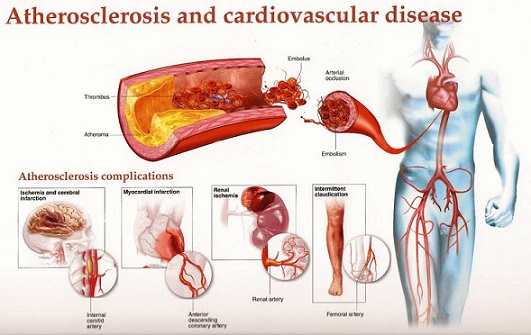 What Are The Warning Signs Of Clogging And How To Resolve It